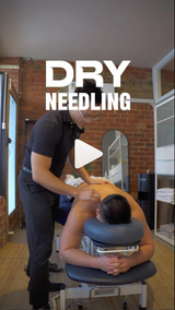 Understanding Dry Needling